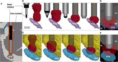 Numerical Study on Electrode Design for Rodent Deep Brain Stimulation With Implantations Cranial to Targeted Nuclei